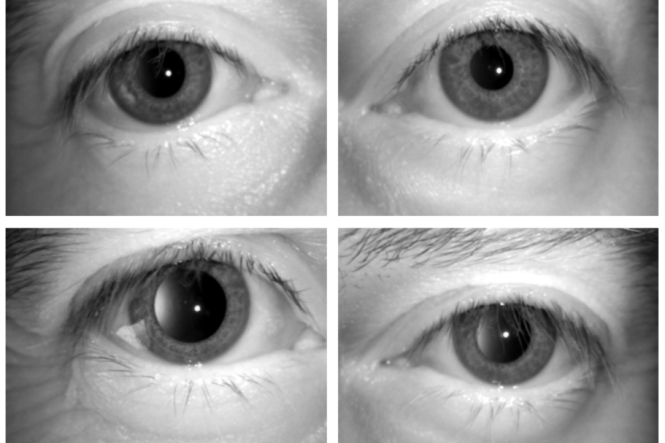 Effects of Alcohol on the Eyes