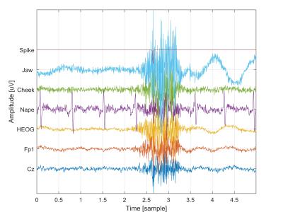 Dataset image