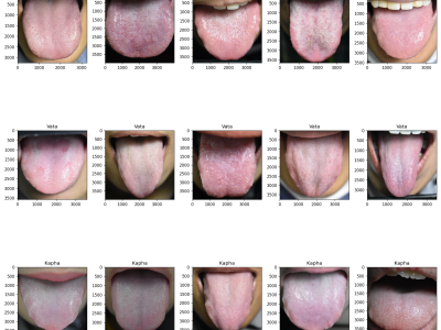 Dataset image
