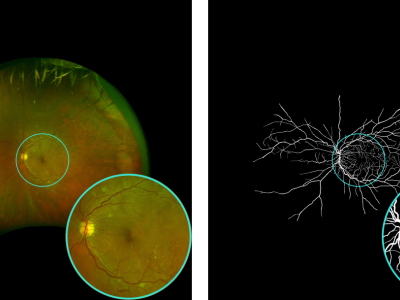 Dataset image